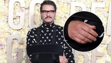 Golden Globes 2024: Why Pedro Pascal had his arm in a sling on the red carpet - and why his manicure says 'ouchy'