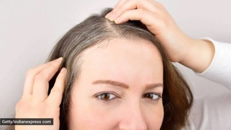 Simple tweaks to prevent grey hair