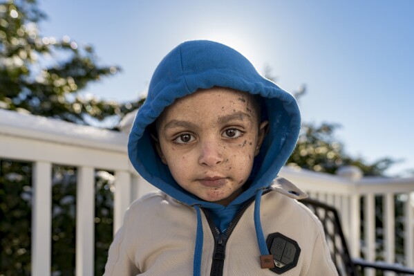 A 4-year-old Gaza boy lost his arm – and his family. Half a world away, he’s getting a second chance