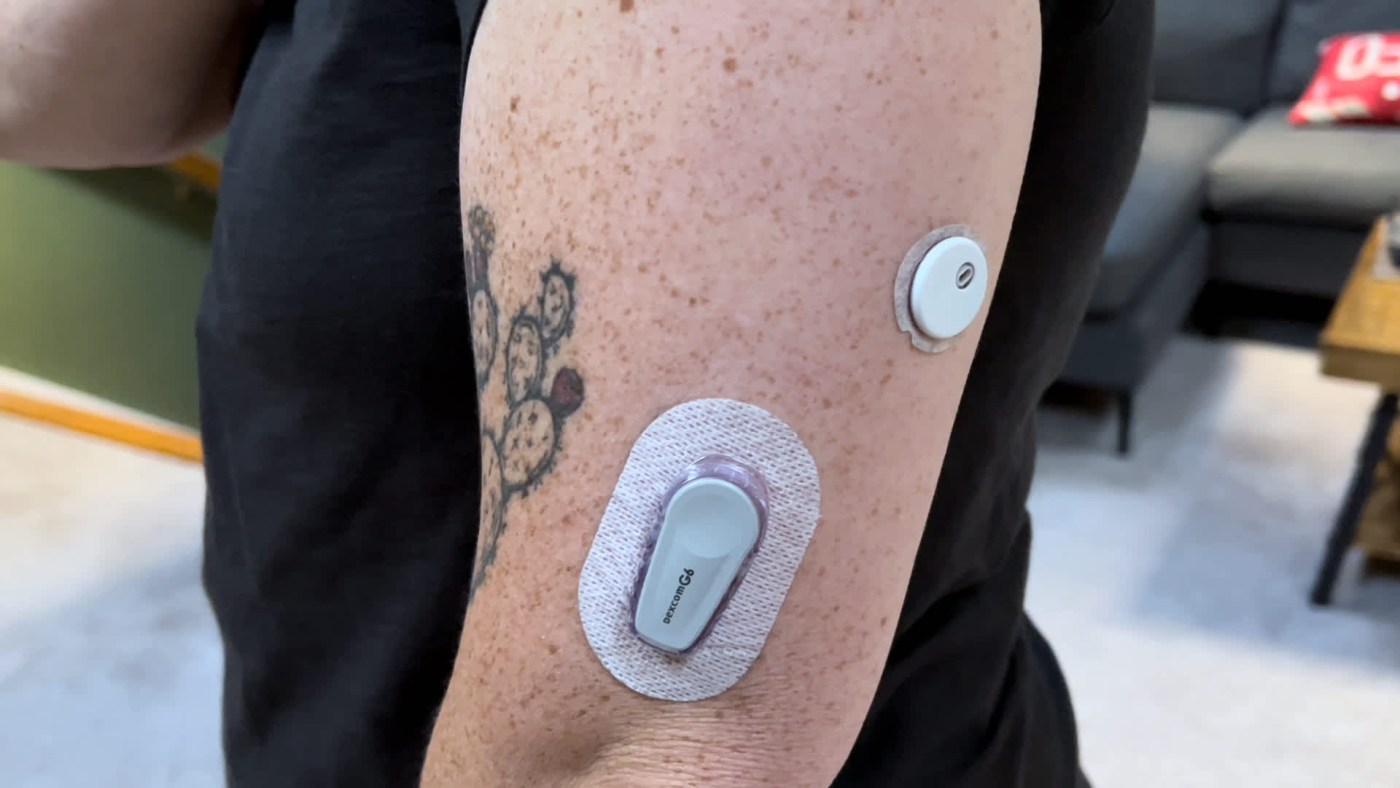 Dexcom announces its first-ever over-the-counter CGM Stelo has been cleared by the FDA