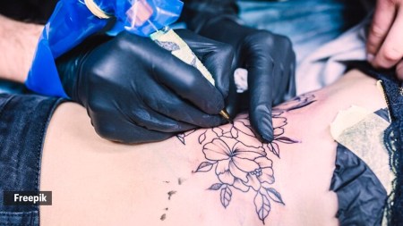 Tattoo regret? How to choose a removal service