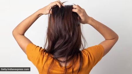 What causes hair loss after your 40s? Can you prevent it?