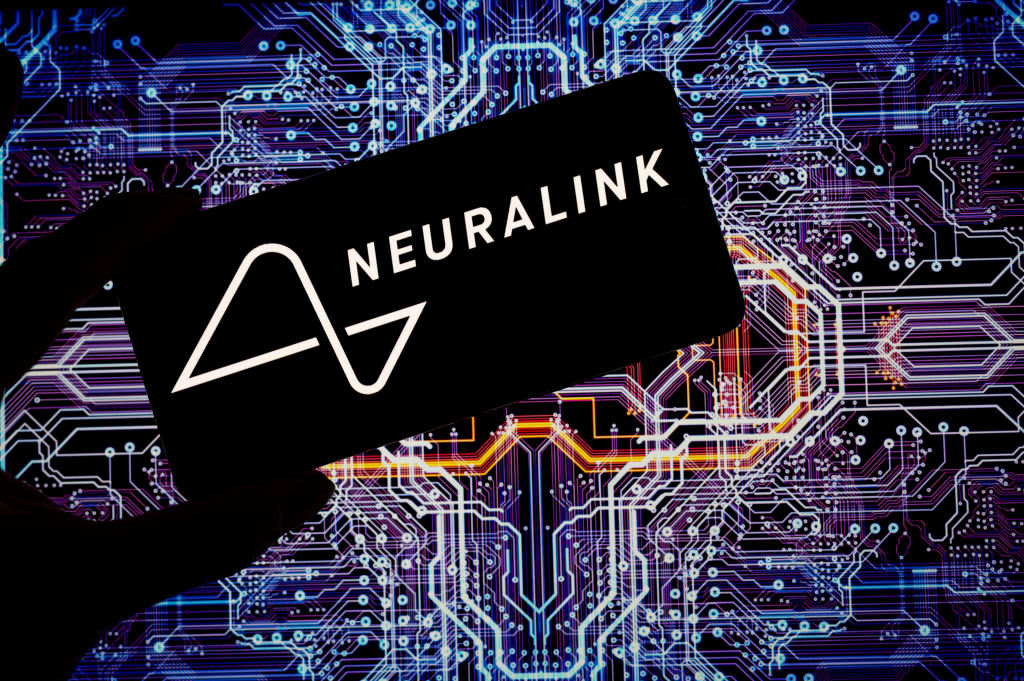 Neuralink's first in-human brain implant has experienced a problem, company says