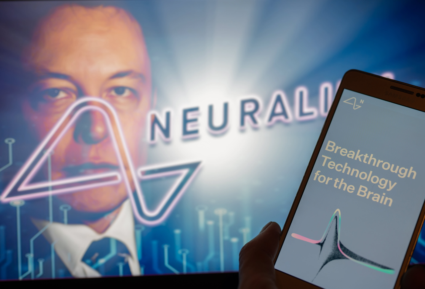 Musk says next Neuralink brain implant expected soon, despite issues with the first patient