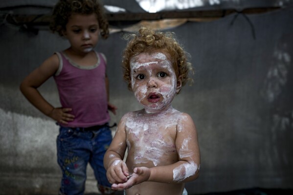 Lice, scabies, rashes plague Palestinian children as skin disease runs rampant in Gaza’s tent camps