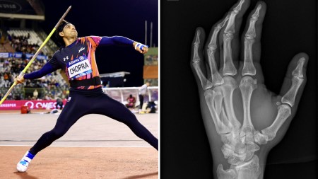 Neeraj Chopra reveals competing in Diamond League Final with fractured hand, shares scans after 2nd-placed finish to season